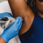 Debunking Myths about Laser Hair Removal for Darker Skin