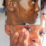 Why Snail Mucin Is Trending On Black Skin Care TikTok