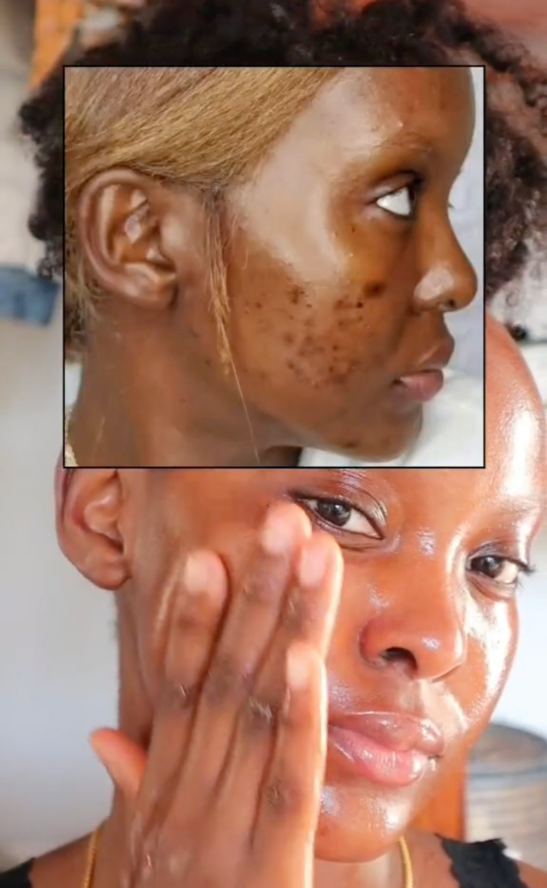 Why Snail Mucin Is Trending On Black Skin Care TikTok