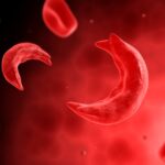 Health Matters: FDA Approves Groundbreaking Gene-Editing Tool That Could Cure Sickle Cell Disease