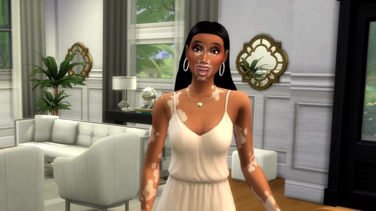 A Vitiligo Skin Feature Is Coming To The Latest ‘Sims’ Game With Help From Winnie Harlow