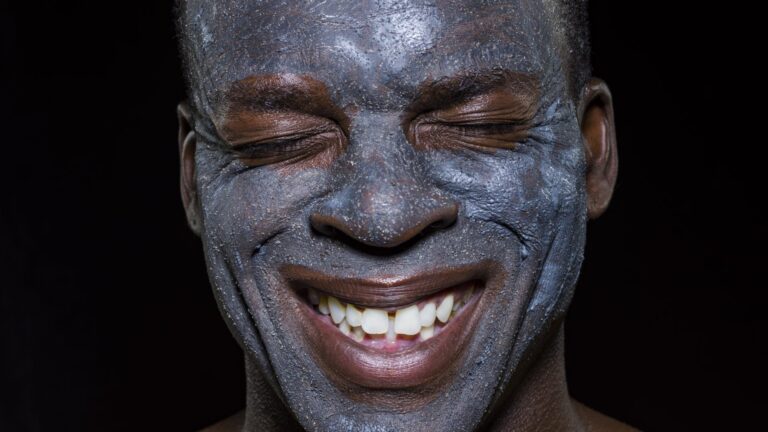 I Tried An Ultra Clear Laser Facial — Here’s How It Went